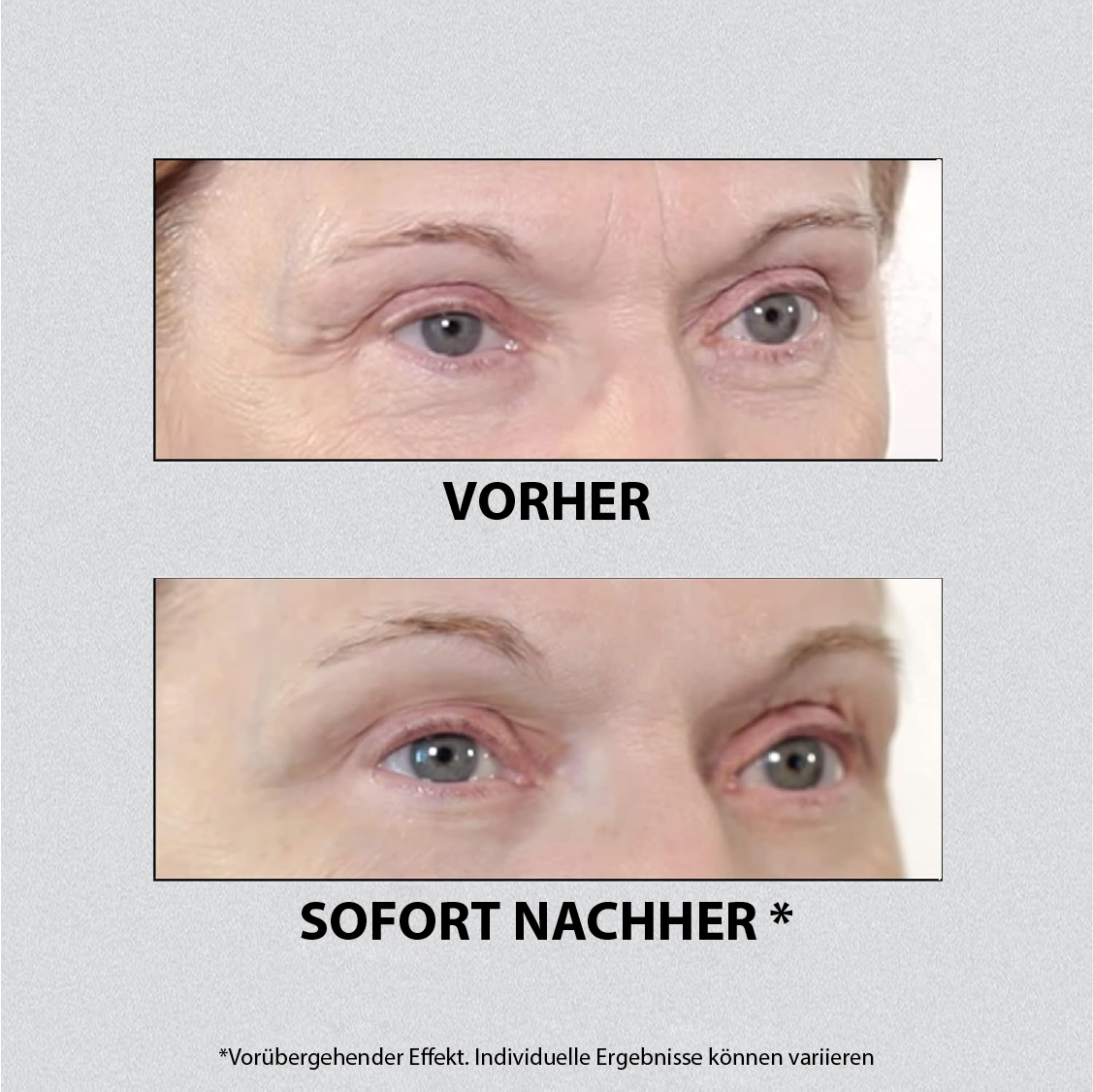 Sofortiges Augenlifting Pro