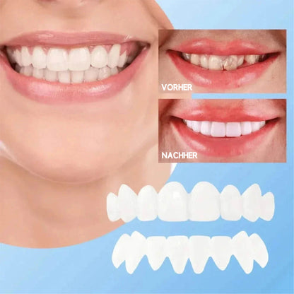 SmileFlex – Dein perfektes Lächeln in Sekunden!