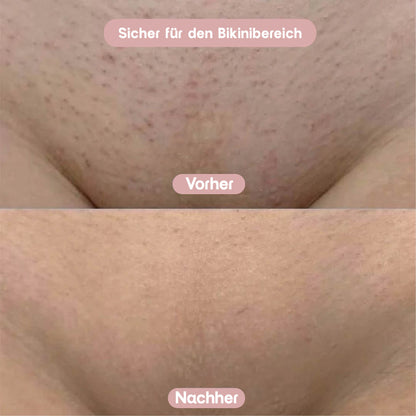 GlowShave - 2-in-1 Körperrasierer für Frauen