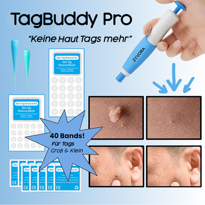 TagBuddy Pro Haut Tag Entferner